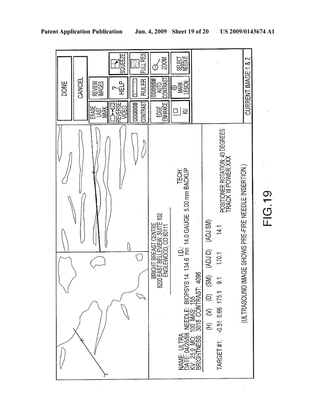 USER INTERFACE SYSTEM FOR MAMMOGRAPHIC IMAGER - diagram, schematic, and image 20