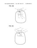 ULTRASONIC PROBE diagram and image