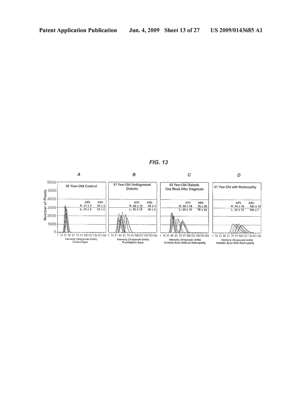 Method and Apparatus for Detecting Diseases Associated with the Eye - diagram, schematic, and image 14