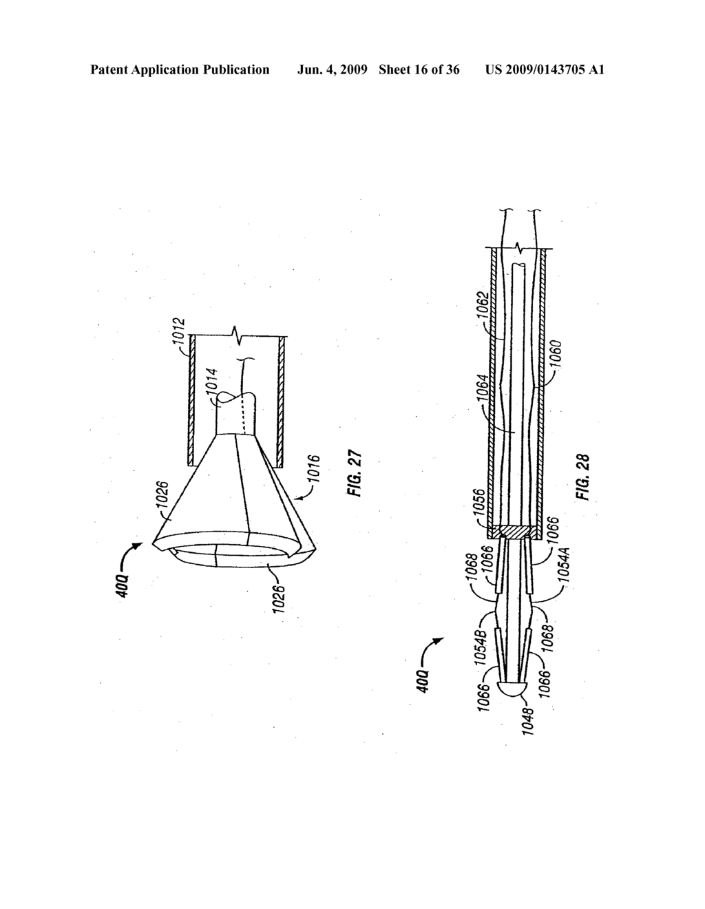 MODIFICATION OF AIRWAYS BY APPLICATION OF ULTRASOUND ENERGY - diagram, schematic, and image 17