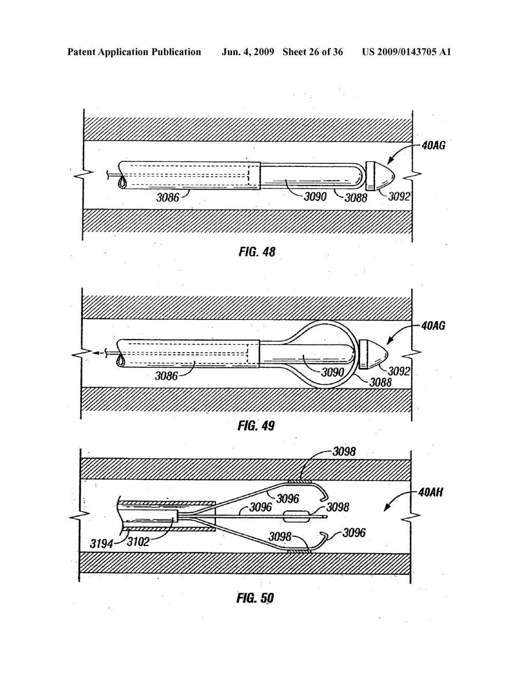 MODIFICATION OF AIRWAYS BY APPLICATION OF ULTRASOUND ENERGY - diagram, schematic, and image 27