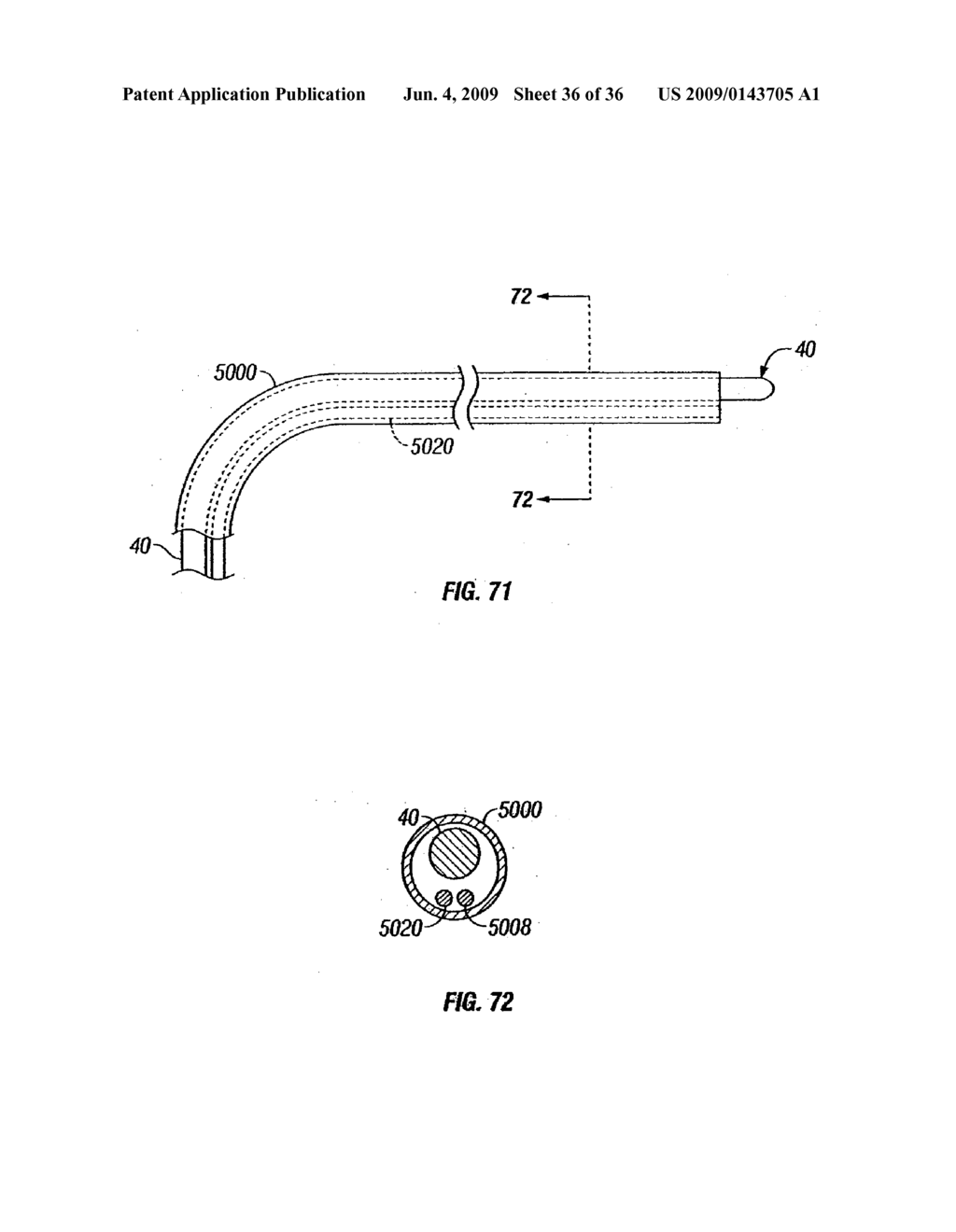 MODIFICATION OF AIRWAYS BY APPLICATION OF ULTRASOUND ENERGY - diagram, schematic, and image 37