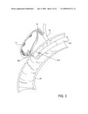 Biliary Shunts, Delivery Systems, Methods of Using the Same and Kits Therefor diagram and image