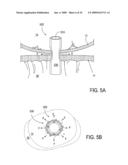 Biliary Shunts, Delivery Systems, Methods of Using the Same and Kits Therefor diagram and image