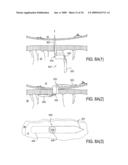 Biliary Shunts, Delivery Systems, Methods of Using the Same and Kits Therefor diagram and image