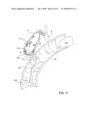 Biliary Shunts, Delivery Systems, Methods of Using the Same and Kits Therefor diagram and image