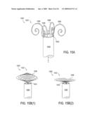 Biliary Shunts, Delivery Systems, Methods of Using the Same and Kits Therefor diagram and image