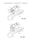 Biliary Shunts, Delivery Systems, Methods of Using the Same and Kits Therefor diagram and image