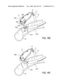 Biliary Shunts, Delivery Systems, Methods of Using the Same and Kits Therefor diagram and image