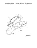 Biliary Shunts, Delivery Systems, Methods of Using the Same and Kits Therefor diagram and image