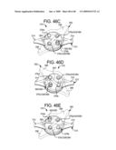 FLOW CONTROL DEVICE FOR PERITONEAL DIALYSIS diagram and image