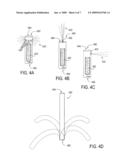 Methods, Devices, Kits and Systems for Defunctionalizing the Gallbladder diagram and image