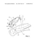 Methods, Devices, Kits and Systems for Defunctionalizing the Gallbladder diagram and image