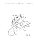 Methods, Devices, Kits and Systems for Defunctionalizing the Gallbladder diagram and image