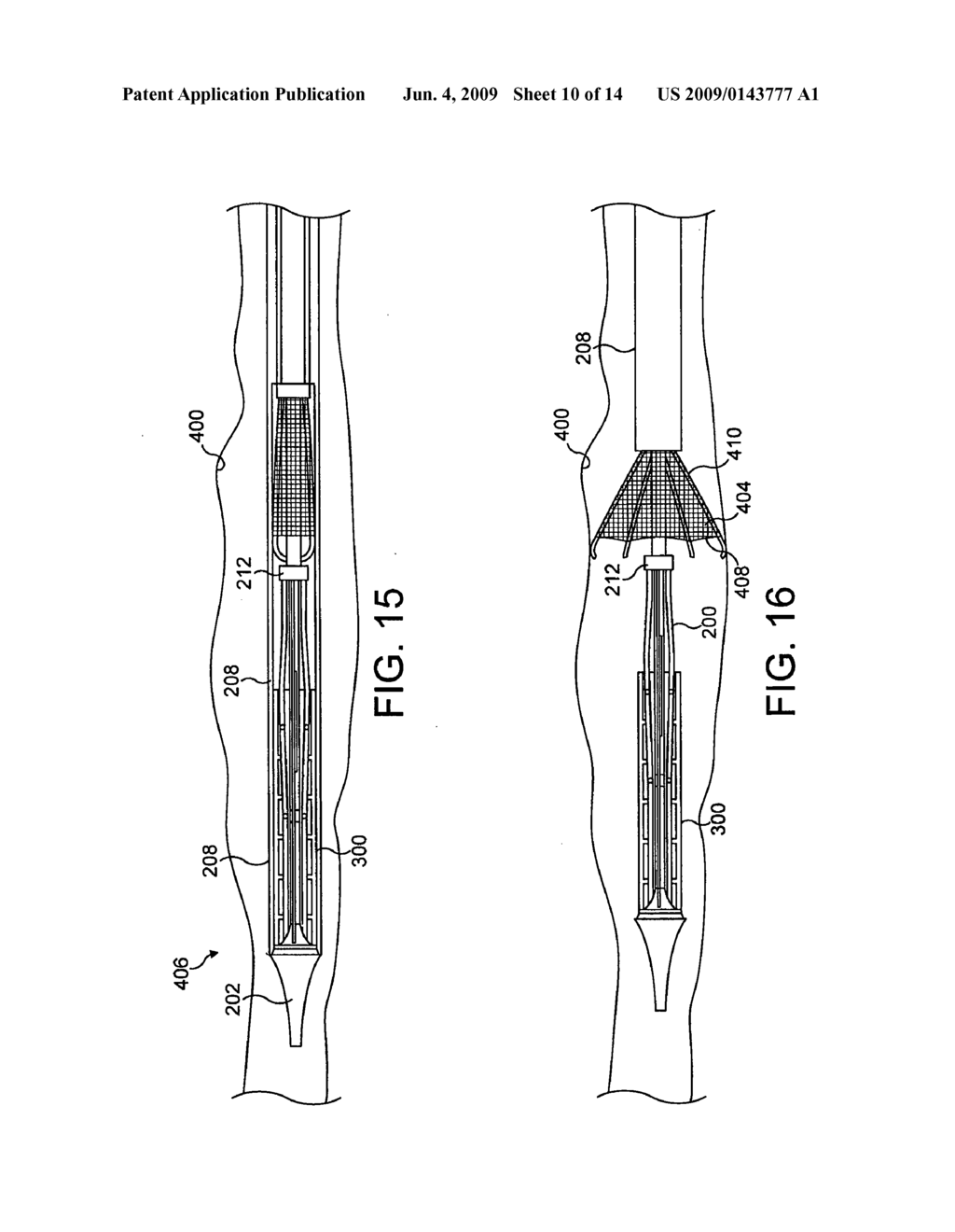 APPARATUS AND METHOD FOR TREATING TISSUE SUCH AS TUMOURS - diagram, schematic, and image 11