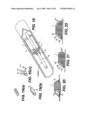 EMBOLIC PROTECTION DEVICE diagram and image