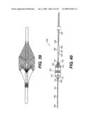 EMBOLIC PROTECTION DEVICE diagram and image