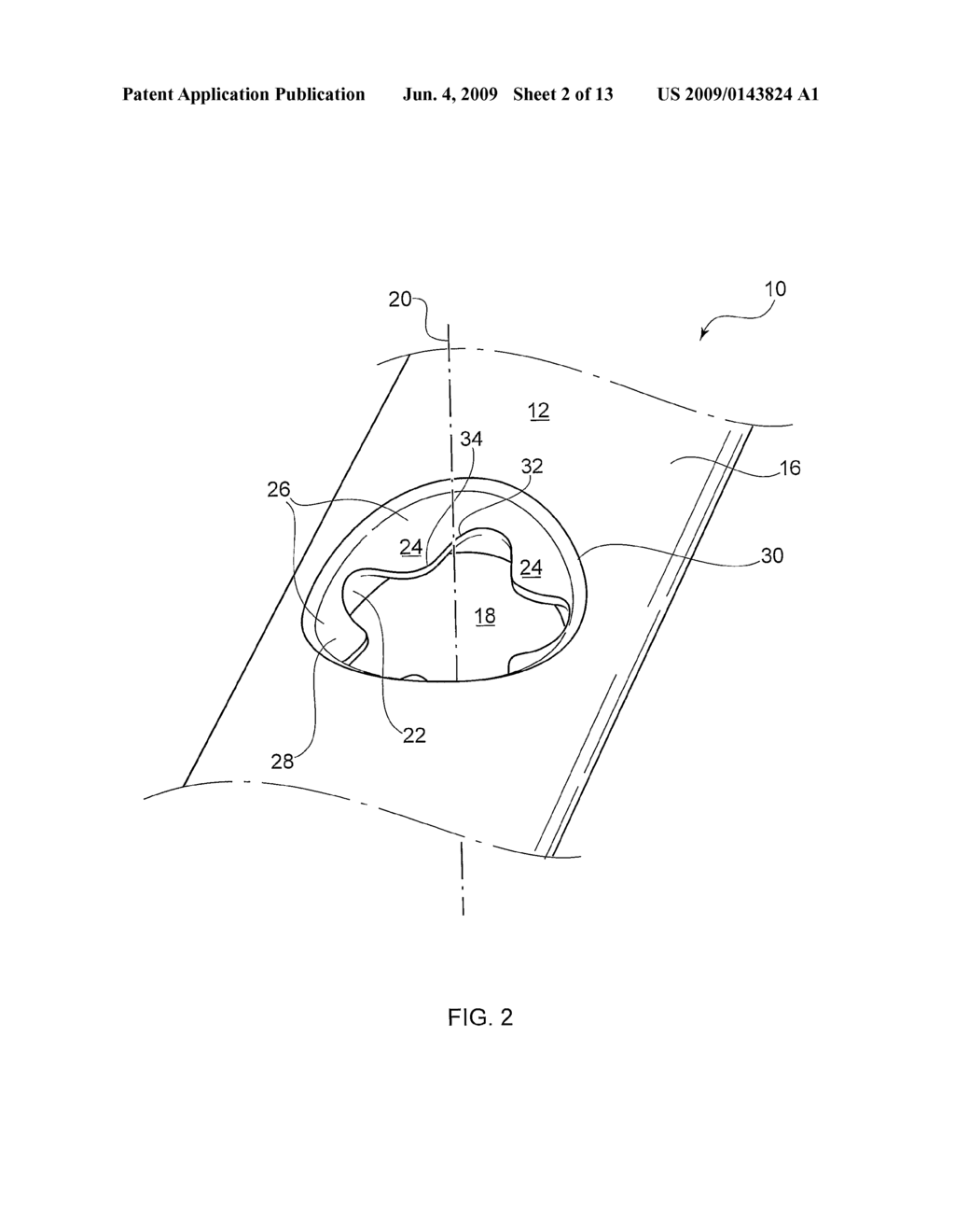 SYSTEMS AND METHODS FOR USING POLYAXIAL PLATES - diagram, schematic, and image 03