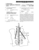 ACCESS DEVICE FOR MINIMALLY INVASIVE SURGERY diagram and image