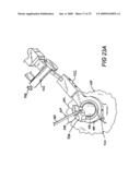 ACCESS DEVICE FOR MINIMALLY INVASIVE SURGERY diagram and image