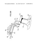 ACCESS DEVICE FOR MINIMALLY INVASIVE SURGERY diagram and image