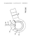 ACCESS DEVICE FOR MINIMALLY INVASIVE SURGERY diagram and image