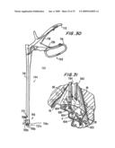 ACCESS DEVICE FOR MINIMALLY INVASIVE SURGERY diagram and image