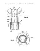 ACCESS DEVICE FOR MINIMALLY INVASIVE SURGERY diagram and image