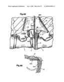 ACCESS DEVICE FOR MINIMALLY INVASIVE SURGERY diagram and image