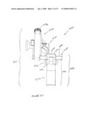 ACCESS DEVICE FOR MINIMALLY INVASIVE SURGERY diagram and image