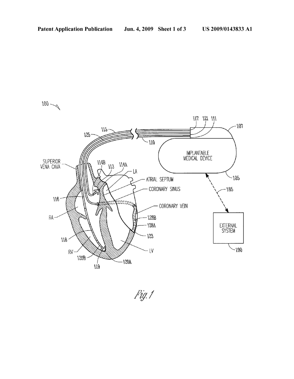 DISABLE FOR ATRIOVENTRICULAR DELAY ADJUSTMENT - diagram, schematic, and image 02