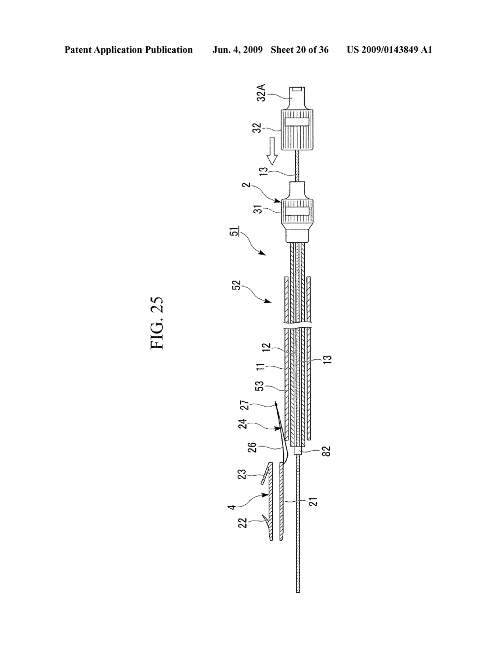 STENT DELIVERY SYSTEM, STENT PLACEMENT METHOD, AND STENT ATTACHMENT METHOD - diagram, schematic, and image 21