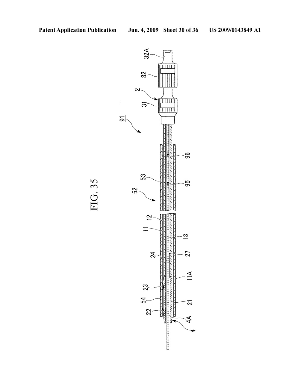 STENT DELIVERY SYSTEM, STENT PLACEMENT METHOD, AND STENT ATTACHMENT METHOD - diagram, schematic, and image 31