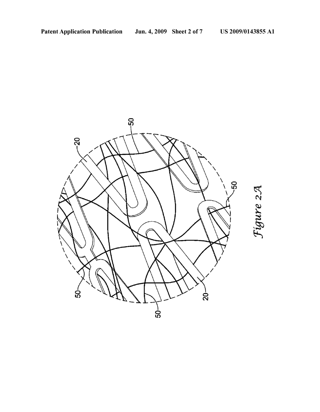 Medical Device Including Drug-Loaded Fibers - diagram, schematic, and image 03