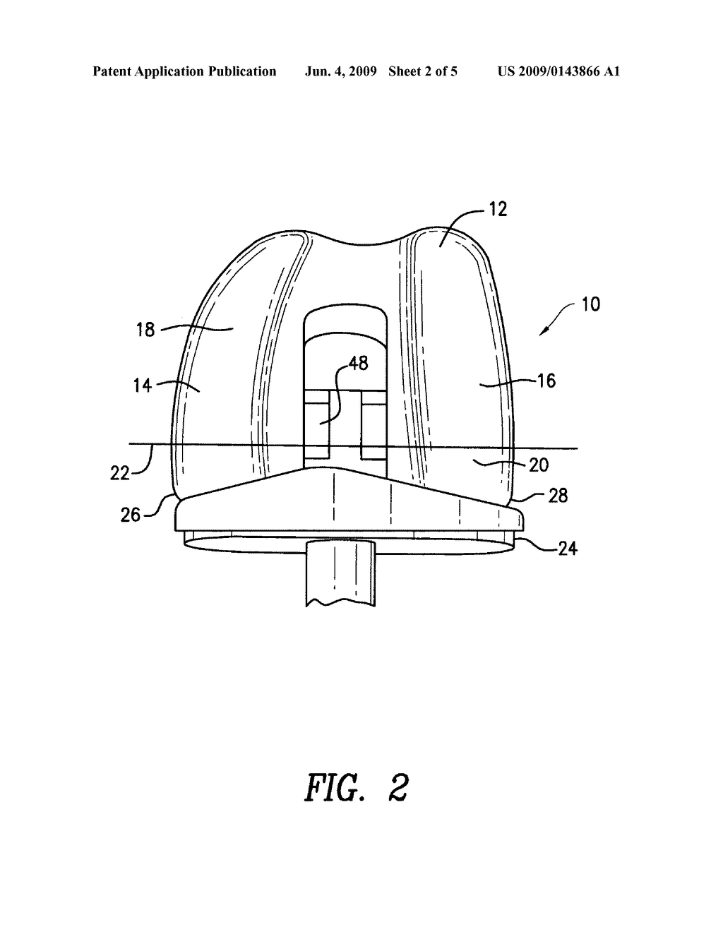 Knee prosthesis with four degrees of freedom - diagram, schematic, and image 03