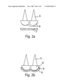 Implants and Methods for Repair, Replacement and Treatment of Disease diagram and image