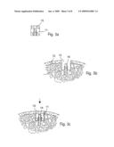 Implants and Methods for Repair, Replacement and Treatment of Disease diagram and image