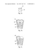 Implants and Methods for Repair, Replacement and Treatment of Disease diagram and image