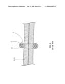 Lace having a Lower Cost of Fabrication diagram and image