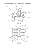 INTERNAL COMBUSTION ENGINES WITH SURCHARGING AND SUPRAIGNITION SYSTEMS diagram and image