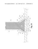 MOUNTING PLATE TO HOLD MEDICAL INSTRUMENTS AND IMPLANTS USING POSTS WITH FLEXIBLE HOLDERS diagram and image