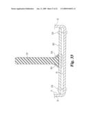 MOUNTING PLATE TO HOLD MEDICAL INSTRUMENTS AND IMPLANTS USING POSTS WITH FLEXIBLE HOLDERS diagram and image