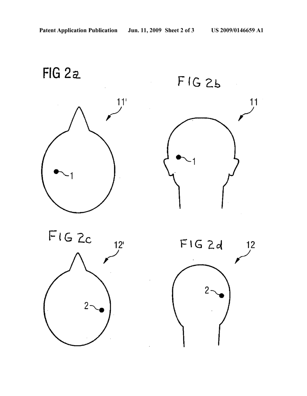 METHOD AND DEVICE FOR AUTOMATIC DETERMINATION OF SLICE POSITIONS IN AN MR EXAMINATION - diagram, schematic, and image 03