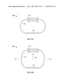 Optical lens displacement systems diagram and image