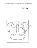 X-RAY CT SYSTEM AND A METHOD FOR CREATING A SCANNING PLAN diagram and image