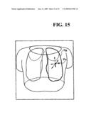 X-RAY CT SYSTEM AND A METHOD FOR CREATING A SCANNING PLAN diagram and image