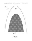 Image segmentation technique for displaying myocardial perfusion that does not show the microbubbles in the cardiac chambers diagram and image