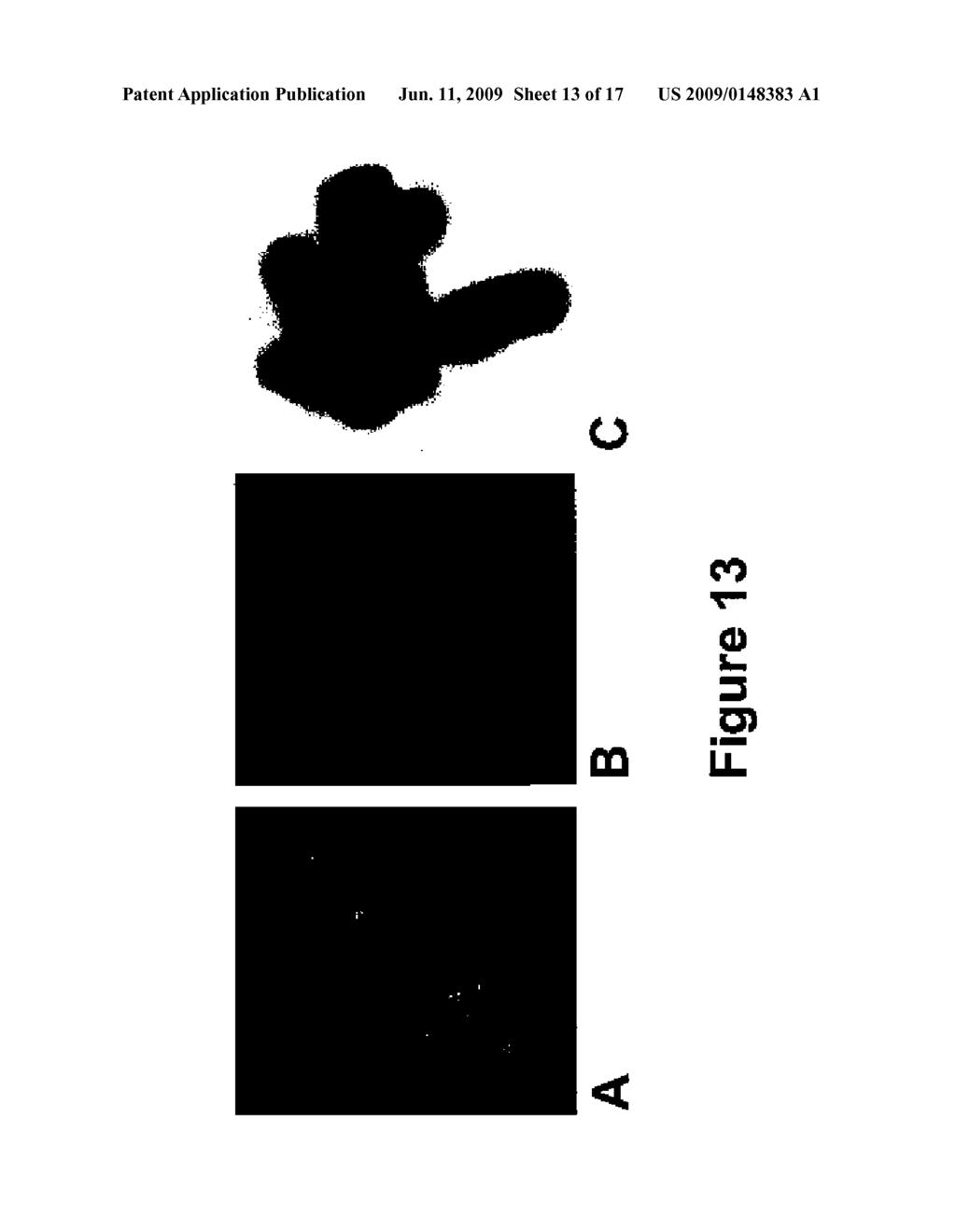 Anticoagulation Agent and Uses Thereof - diagram, schematic, and image 14