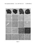 Glycine N-methyltransferase (GNMT) Animal model and use thereof diagram and image