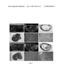 Glycine N-methyltransferase (GNMT) Animal model and use thereof diagram and image